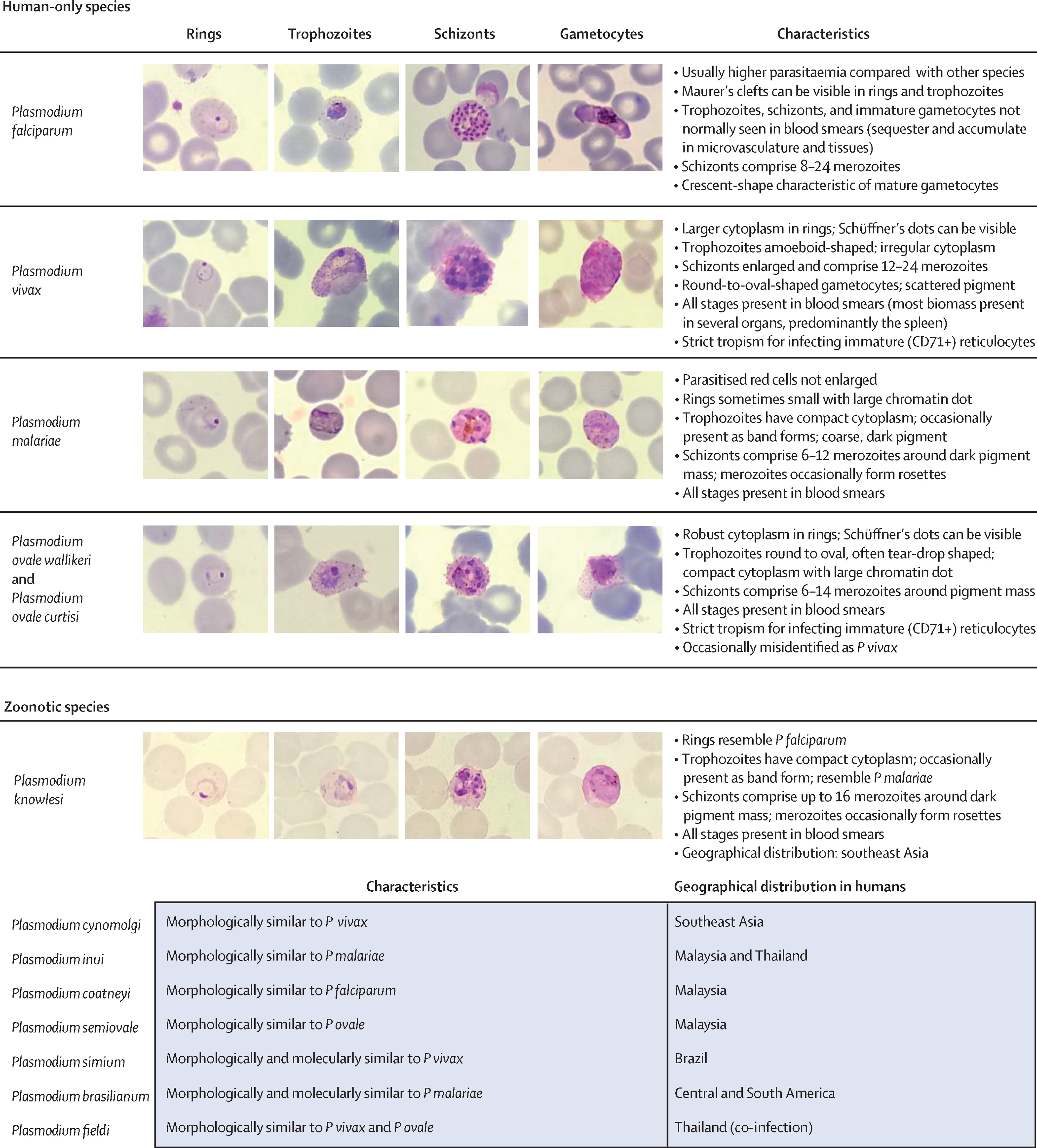 Microscopie van vijf Plasmodium soorten in dunne bloeduitstrijk